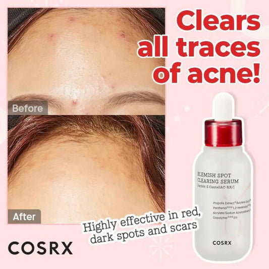 COSRX Blemish Spot Clearing Serum – 40ml | Dark Spot, Post-Acne Mark & Brightening Face Serum
