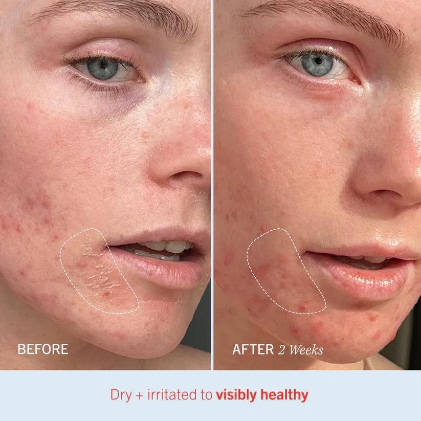 First Aid Beauty Ultra Repair Cream Intense Hydration 170.1g