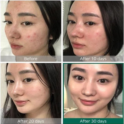 SOMEBYMI - AHA BHA PHA 30 Days Miracle Toner - 150 ml