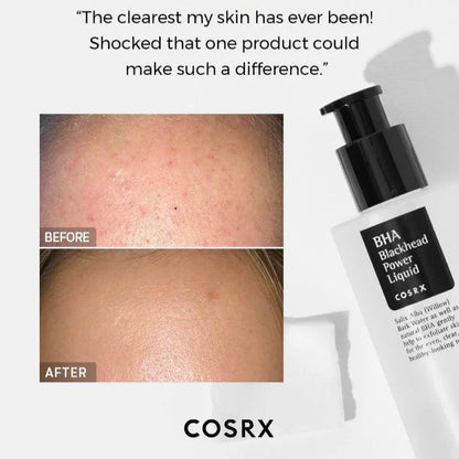 COSRX BHA Blackhead Power Liquid 100ml - Exfoliating Toner for Clear, Poreless Skin