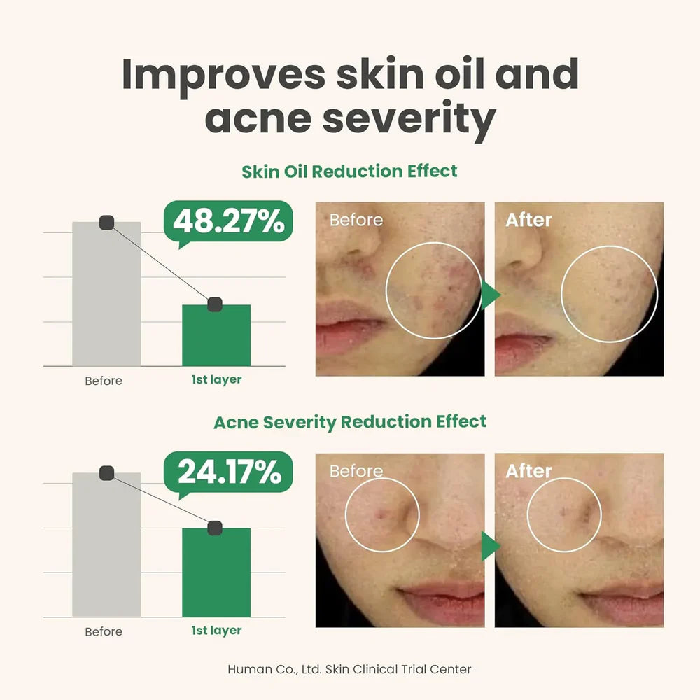 AXIS-Y The Spot Difference Blemish Treatment Serum – 15ml | Acne, Pore & Spot Care with AHA + BHA