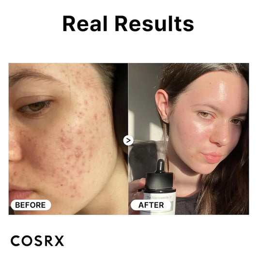 COSRX The Niacinamide 15 Serum 20ml – Pore Minimizing & Blemish Care Serum