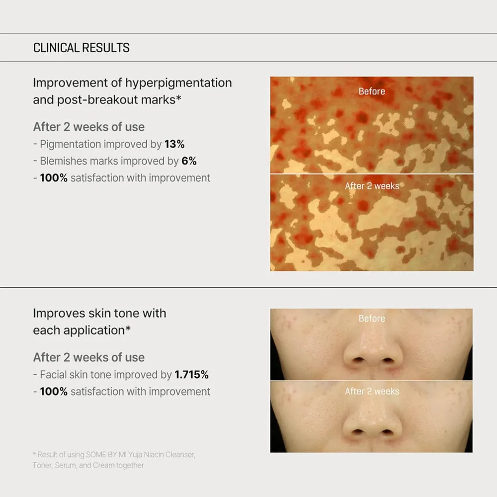 SOME BY MI Yuja Niacin Anti Blemish Cream – 60ml | Brightening, Dark Spot & Moisturizing Care