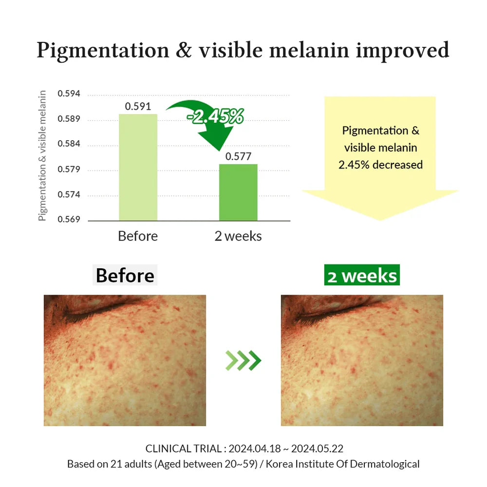 Dr. Althea Gentle Vitamin C Serum 30ml – Brightening, Dark Spot & Hydrating Serum