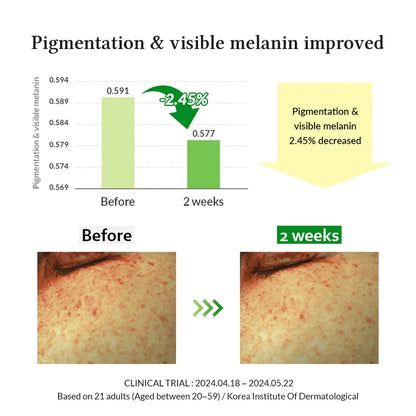Dr. Althea Gentle Vitamin C Serum 30ml – Brightening, Dark Spot & Hydrating Serum