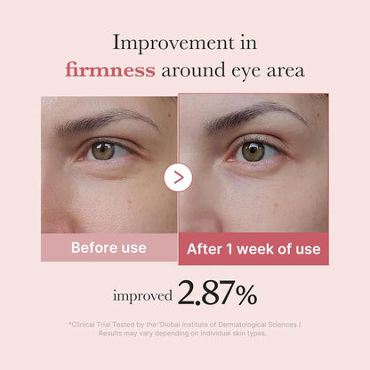 Medicube - PDRN Pink Peptide Eye Cream - 30ml