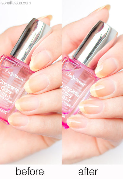 Buy Sally Hansen Complete Care 7 in 1 Nail Treatment - 13.3ml in Pakistan