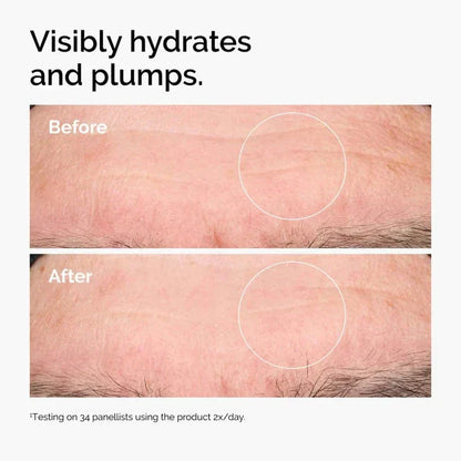 The Ordinary Hyaluronic Acid 2% + B5 30ml