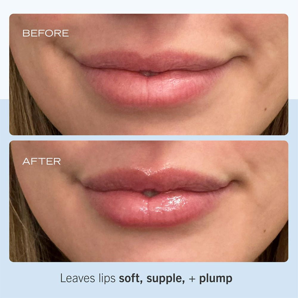 First Aid Beauty  Ultra Repair Lip Balm