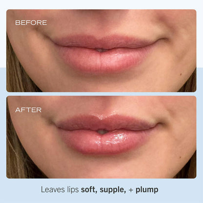 First Aid Beauty  Ultra Repair Lip Balm