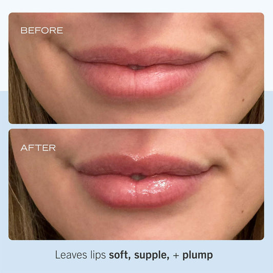 First Aid Beauty  Ultra Repair Lip Balm